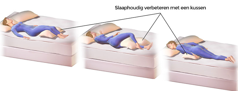 Rugklachten en slaaphouding