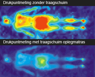 Veerkracht en tegendruk